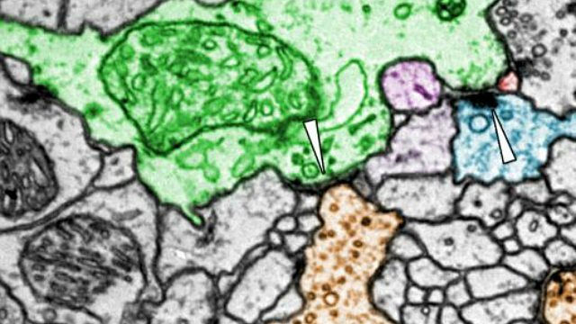 Snímek elektronové mikroskopie odhalující neuronová spojení v mozku samičky mušky octomilky