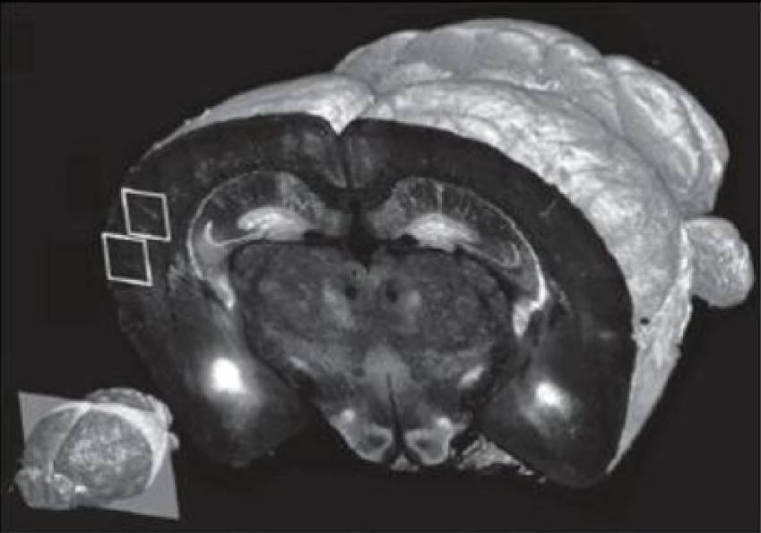 zobrazení mozku prostřednictvím STP tomografie